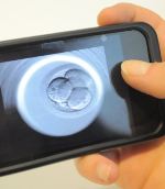 Ученые создали программу на телефон, которая показывает эмбрионов в режиме реального времени