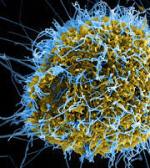 Два больных американца, больных на лихорадку Ebola, возвращаются в США