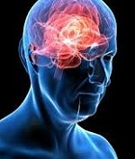 Сотрясение мозга может стать причиной болезни Альцгеймера