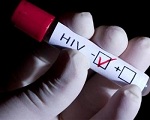 Быстрое тестирование на ВИЧ в аптеках