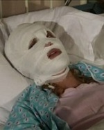 Невесту облили кислотой!
