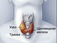 Онкология щитовидной железы