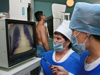 Туберкулез костей симптомы